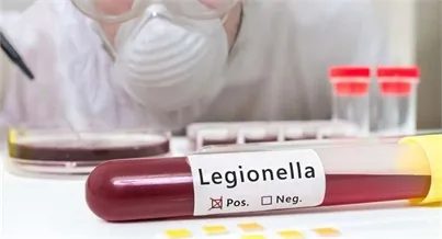 Điều kiện sống của Legionella